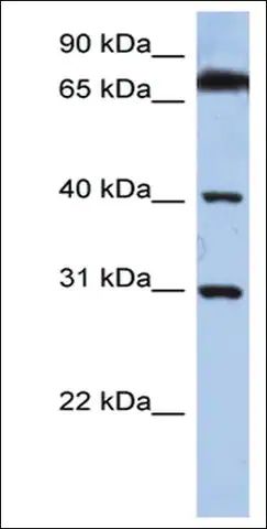 ANTI-DHRSX antibody produced in rabbit