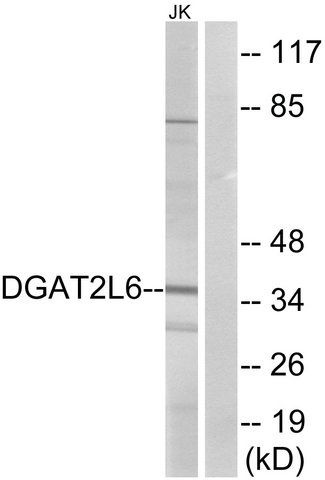 Anti-DGAT2L6 antibody produced in rabbit