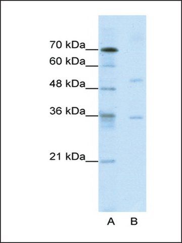 Anti-DIDO1 (AB1) antibody produced in rabbit