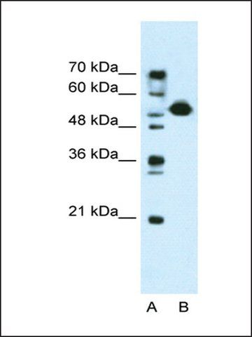 Anti-DKFZP781I1119 antibody produced in rabbit