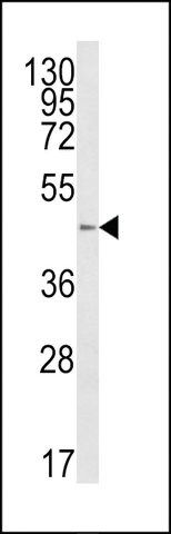 ANTI-B4GALT1(C-TERMINAL) antibody produced in rabbit