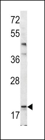 ANTI-BAD BH3 DOMAIN antibody produced in rabbit