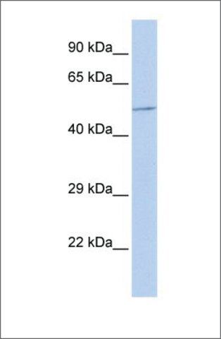 Anti-B4GALT3 antibody produced in rabbit