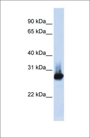 Anti-BCAP31 antibody produced in rabbit