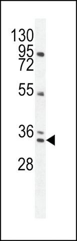 ANTI-BCA3(N-TERMINAL) antibody produced in rabbit