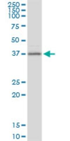 Anti-BCAT2 antibody produced in mouse