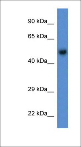 Anti-BFAR antibody produced in rabbit