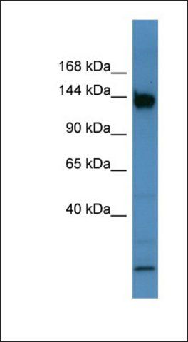 Anti-BNC1 antibody produced in rabbit