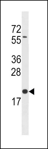 ANTI-BLOC1S3(C-TERMINAL) antibody produced in rabbit