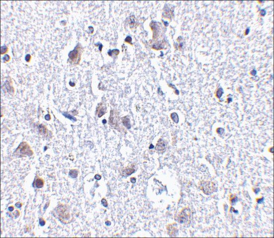 Anti-BRSK1 antibody produced in rabbit