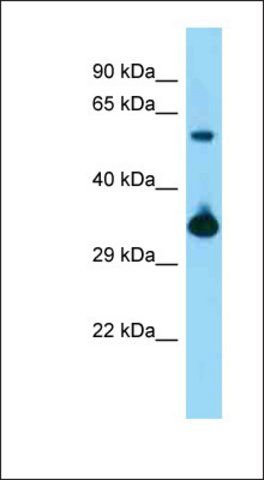 Anti-BMI1 antibody produced in rabbit