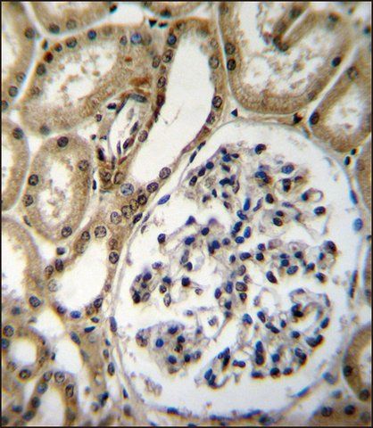 ANTI-BRUNOL6 (N-TERM) antibody produced in rabbit