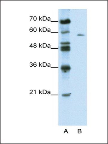 Anti-BTBD14A antibody produced in rabbit