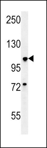 ANTI-BUB1A(N-TERMINAL) antibody produced in rabbit