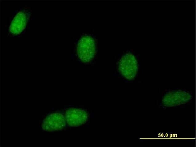 Anti-BRWD1 antibody produced in mouse