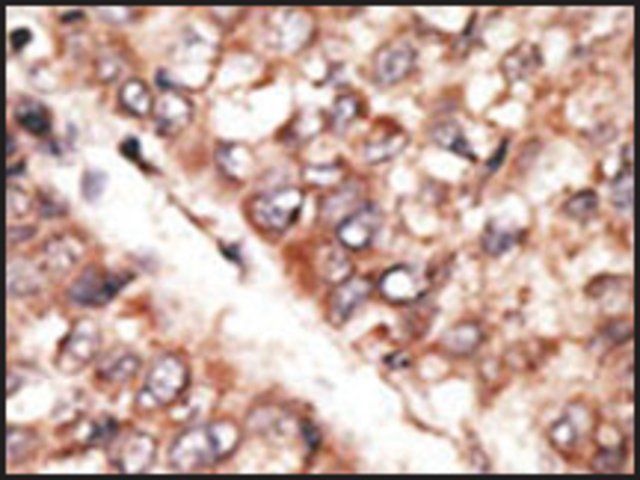 Anti-BMP15 (center) antibody produced in rabbit