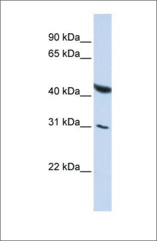 Anti-BRUNOL6 antibody produced in rabbit