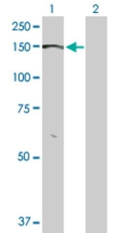 Anti-BMPR2 antibody produced in rabbit