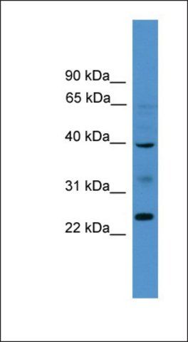 Anti-BTNL8 antibody produced in rabbit