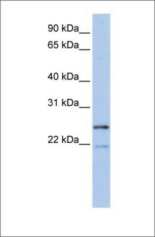 Anti-BTF3L3 antibody produced in rabbit