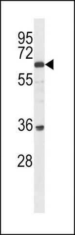 ANTI-BTBDG (N-TERM) antibody produced in rabbit