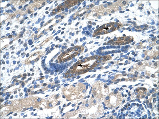 Anti-BTBD14A antibody produced in rabbit