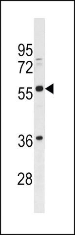 ANTI-BTN2A3 (CENTER) antibody produced in rabbit