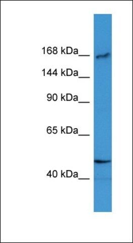 Anti-BTBD12 antibody produced in rabbit