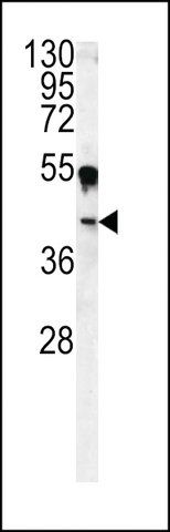 ANTI-CA14(N-TERMINAL) antibody produced in rabbit