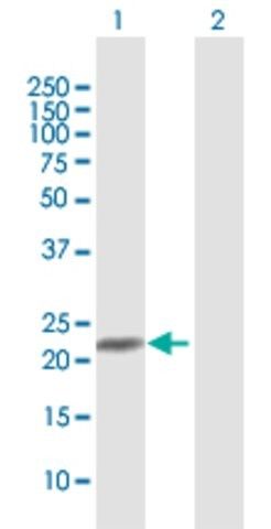 Anti-C9orf95 antibody produced in rabbit