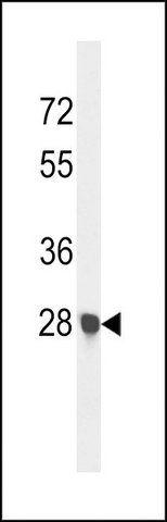 ANTI-CA2 (N-TERM) antibody produced in rabbit