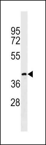 ANTI-CC113 (C-TERM) antibody produced in rabbit