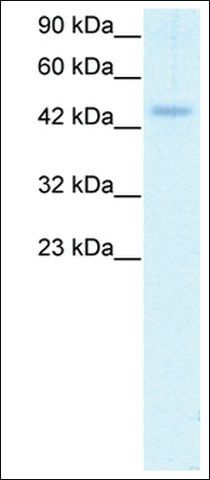 Anti-CALR (AB2) antibody produced in rabbit