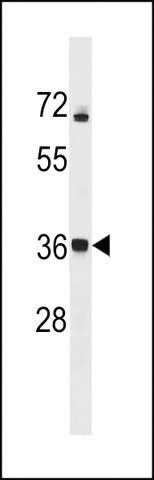 ANTI-CALHM3(N-TERMINAL) antibody produced in rabbit