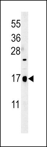 ANTI-CA095 (C-TERM) antibody produced in rabbit