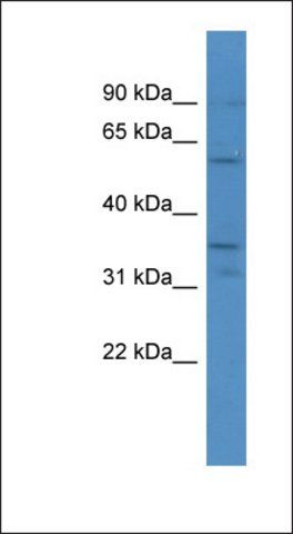 Anti-CA5A antibody produced in rabbit