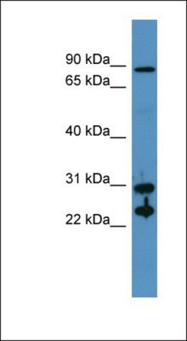 Anti-CA2 antibody produced in rabbit