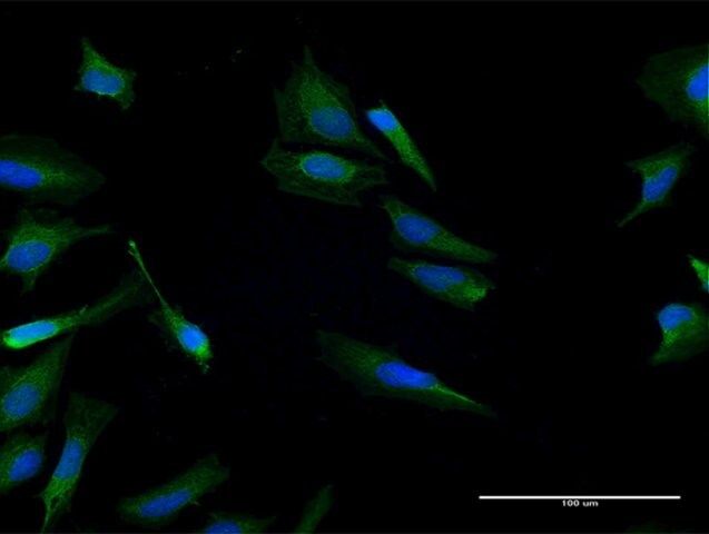 Anti-CALCB antibody produced in mouse