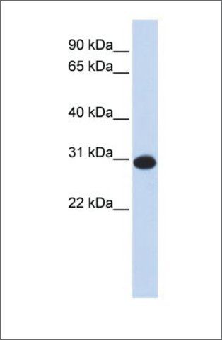 Anti-CAMLG antibody produced in rabbit