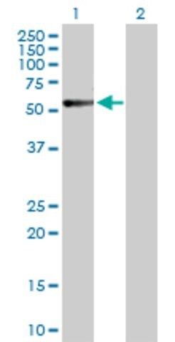 Anti-CALCR antibody produced in rabbit