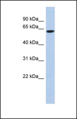 Anti-CAMKV, (N-terminal) antibody produced in rabbit