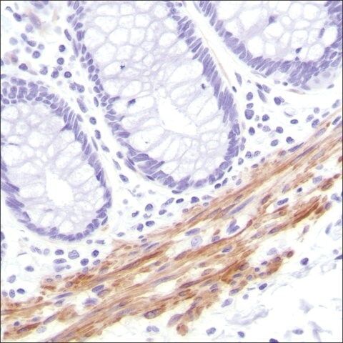 Anti-Calponin-1 antibody, Rabbit monoclonal