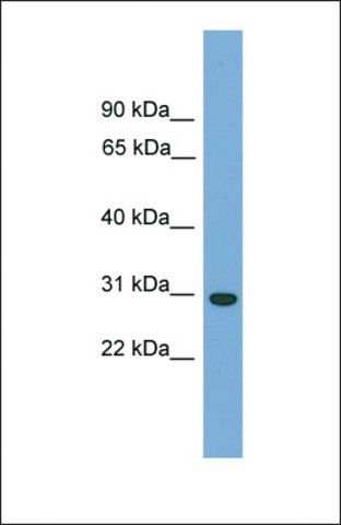 Anti-CA5B, (N-terminal) antibody produced in rabbit