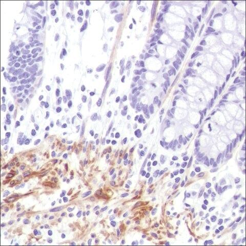 Anti-Calponin-1 antibody, Rabbit monoclonal