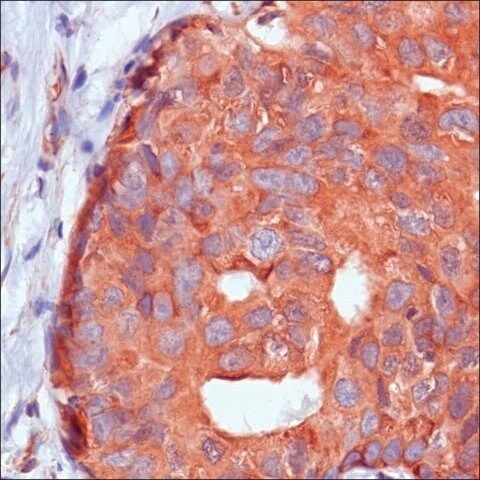 Anti-Calpastatin antibody, Rabbit monoclonal