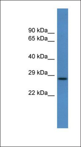 Anti-CALY antibody produced in rabbit