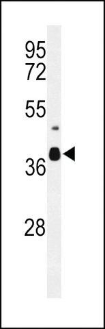 ANTI-CC058 (CENTER) antibody produced in rabbit