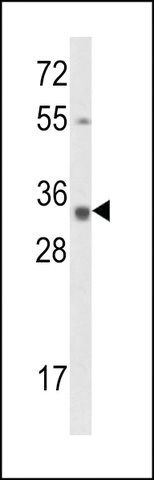 ANTI-CALPONIN-3(N-TERMINAL) antibody produced in rabbit