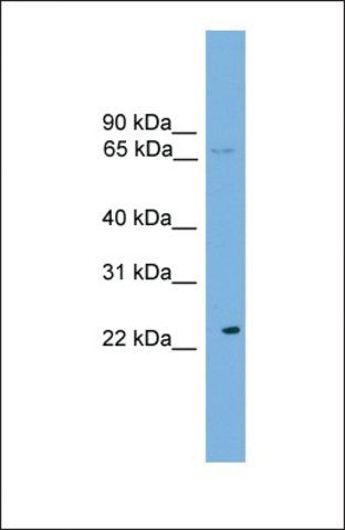 Anti-CALCOCO1, (N-terminal) antibody produced in rabbit