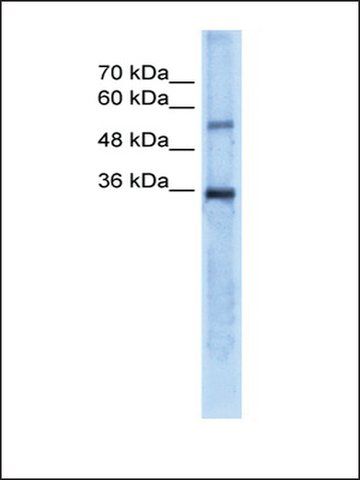 Anti-CA8 antibody produced in rabbit